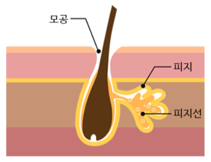 비듬없애는방법